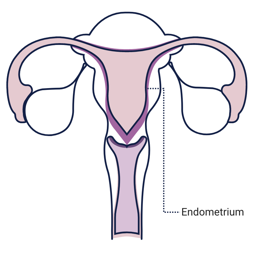 Understanding Endometrial Testing in IVF