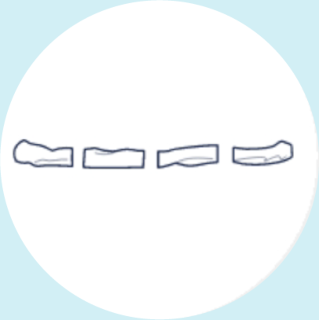 After cord blood collection and delivery of the placenta, a 10 to 15 cm section of the umbilical cord is cleaned and cut.